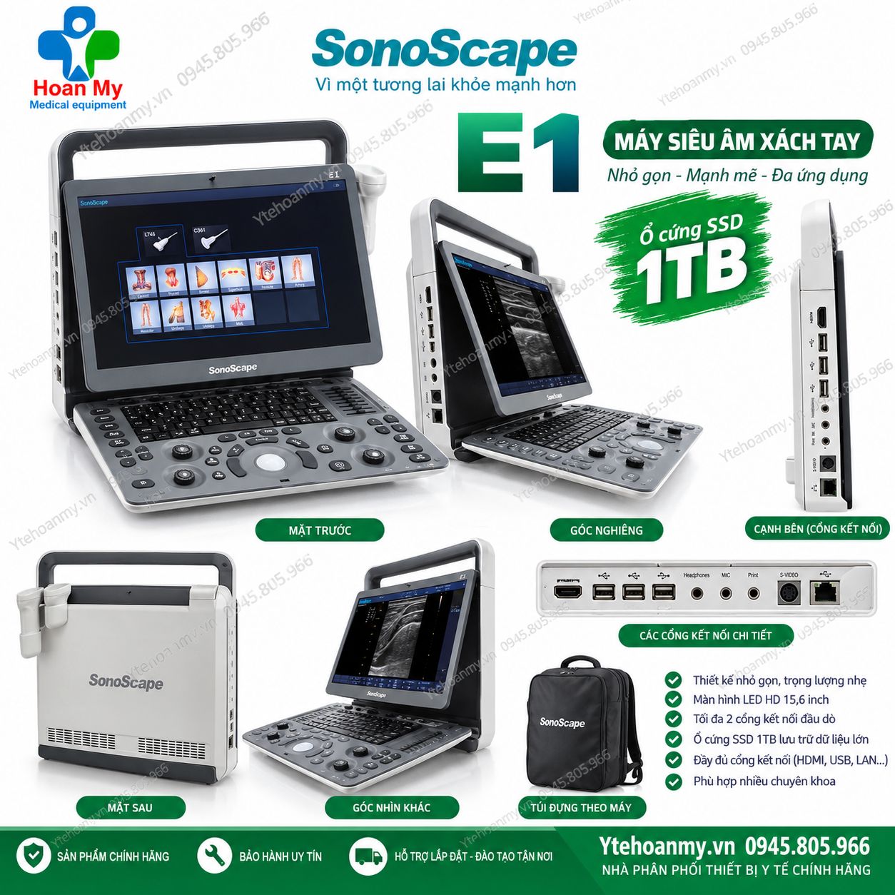 M&aacute;y si&ecirc;u &acirc;m x&aacute;ch tay Sonoscape E1 15.6 inch Full HD, FDA Mỹ
